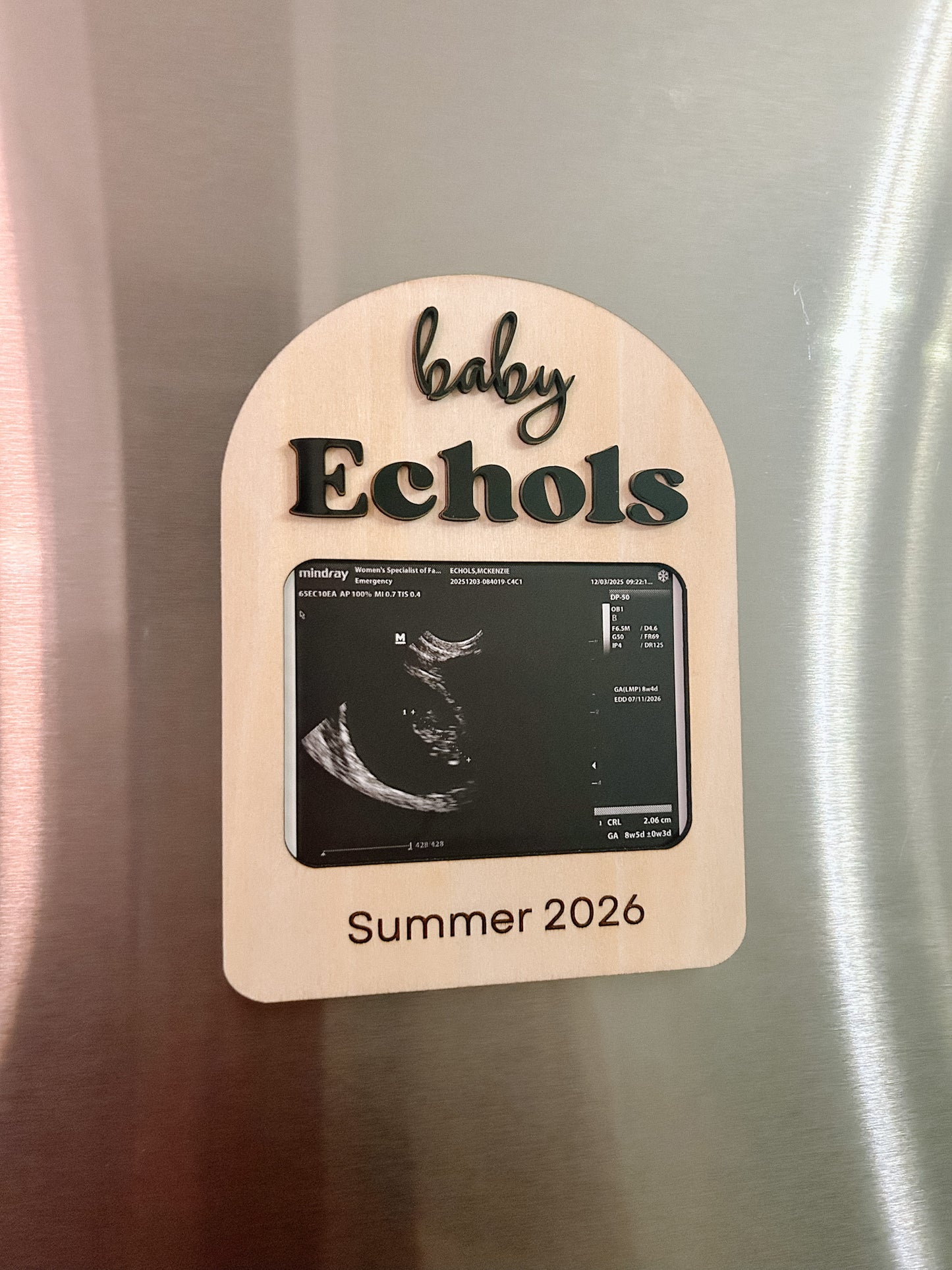 Sonogram - Pregnancy Announcement - Photo Frame